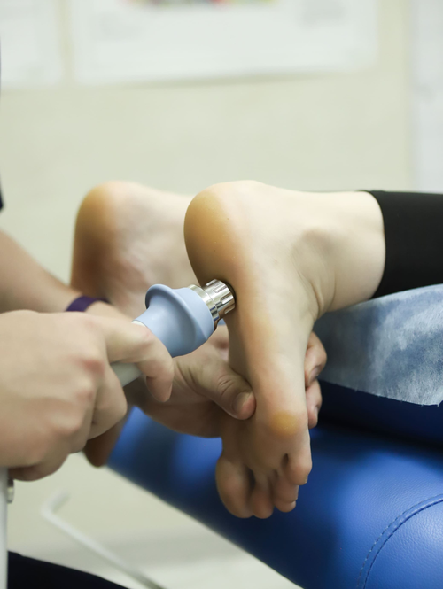 Ударно-волновая терапия